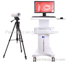 Digital Electronic Trolley Video Colposcope