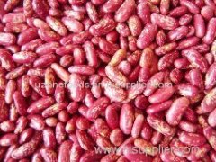 Grade AA Quality Red kidney Beans