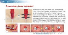 CE approved medical vagina treatment fractional CO2 laser machine scar removal