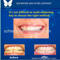 BEAUTIFUL Cold light tooth whitening kit 30 min every day whitening your teeth Professional Tooth Whitener quick easy