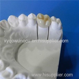 Zirconia Crown And Bridge