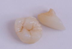 porcelain material porcelain teeth porcelain denture
