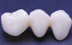 beautiful and natural porcelain teeth
