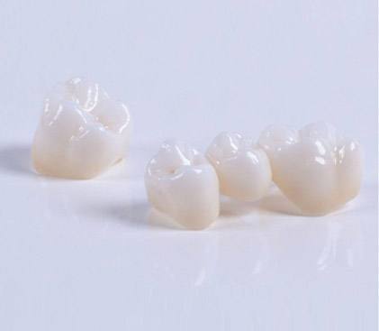 realistic and beautiful porcelain teeth and no stimulation to the peripheral tissues