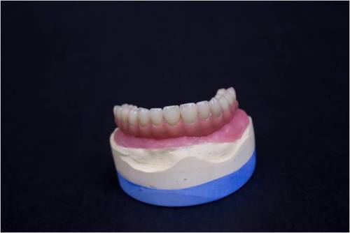 Implant Porcelain Teeth dental porcelain teeth