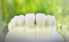 porcelain material porcelain teeth porcelain product