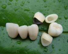 alloy ceramic teeth ceramic denture ceramic material