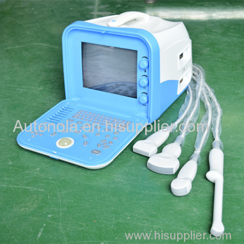 factory price Autonola portable veterinary ultrasound equipment