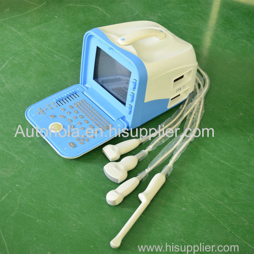 factory price Autonola portable veterinary ultrasound equipment