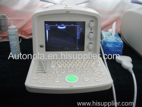 2d portable ultrasound machine price veterinary ultrasound