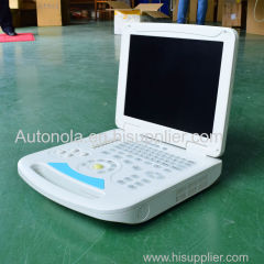 Cheap price notebook color doppler &echo doppler ultrasound