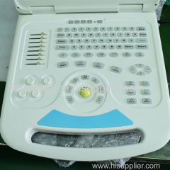 High quality color doppler ultrasound machine/doppler vascular