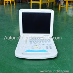 High quality color doppler ultrasound machine/doppler vascular