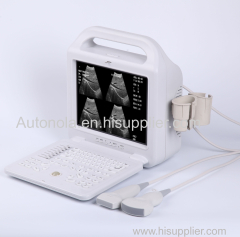 Factory cheap price of Laptop veterinary ultrasound scanner