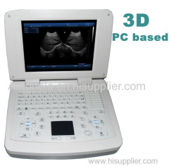 Hot sale notebook ultrasound scanner PC based