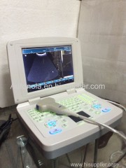 Notebook full digital windows ultrasound scanner