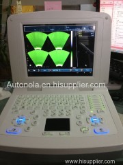 Notebook full digital windows ultrasound scanner