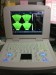 Hot sale notebook ultrasound scanner PC based
