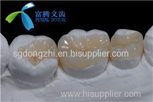 Composite/Resin restorations for Crown/Bridge/Onlay/Inlay/veneers from Shofu