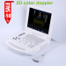 Notebook color doppler ultrasound