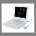 Newest ATNL-6800 Full-digital Notebook Color Doppler System and convex arrray probe