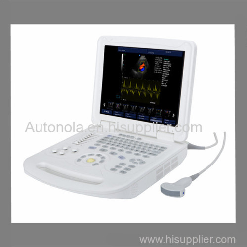 Newest ATNL-6800 Full-digital Notebook Color Doppler System and convex arrray probe