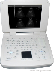 Full digital laptop veterinary diagnostic system ultrasound scanner with factory price