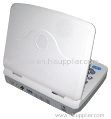 Full digital laptop veterinary diagnostic system ultrasound scanner with factory price