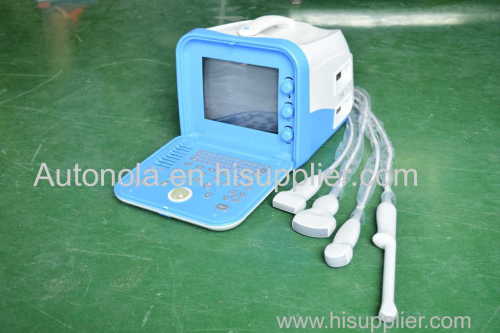 ATNL51353A Digital Portable Ultrasound Scanner Standard configuration 60R/3.5MHZ Convex array probe 1pc