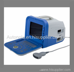 High-quality Digital Newest Animal Portable Ultrasound Scanner Company