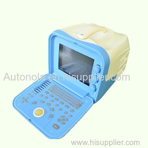 Big animal ultrasound machine & Medical equipment ultrasound scanner