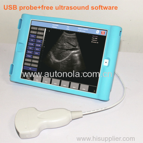 80 elements USB andriod ultrasound convex array probe