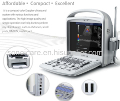 China Human Color Doppler System/2D Color Doppler Ultrasound scanner/CE Color Doppler USG/ Color Sonography/18-month usg