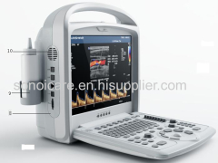 China Human Color Doppler System/2D Color Doppler Ultrasound scanner/CE Color Doppler USG/ Color Sonography/18-month usg