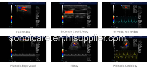 Advanced Animal/VET Color Doppler System/2D Color Doppler Ultrasound/CE Color Doppler USG/ Color Sonography/18-month usg