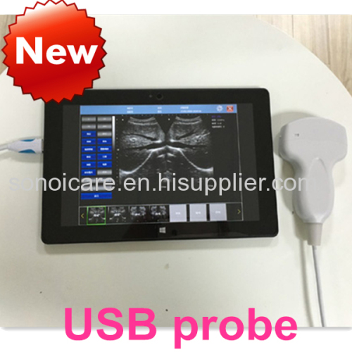 Advanced Human/VET Probe Ultrasound Scanner/USB convex probe USG/CE pocket probe ultrasonic machine/Sonography device