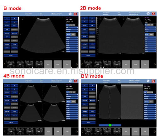 Advanced high-tech Human/VET Probe Ultrasound/USB convex probe USG/CE pocket probe ultrasonic machine/Sonography device