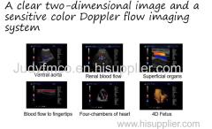 China 4D Color Doppler Ultrasound Scanner Manufacturer