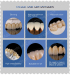 Zotion Affini China dental supplier High strength ceramic zirconia block