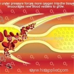 Sitting Type Hyperbaric Chamber For Helathcare