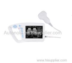 Autonola Medical equipment producers Full Digital Palm Ultrasound Scanner