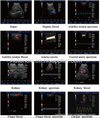 Full-digital Trolley Color Doppler Ultrasound Scanner ATNL6800