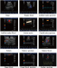 Patient monitor Full-digital Trolley Color Doppler Ultrasound Scanner (ATNL6800)