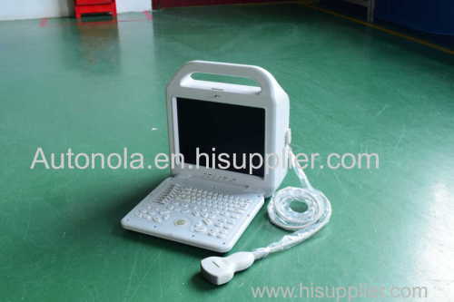 12 inch LCD monitor Medical equipment Digital Laptop Ultrasound Scanner