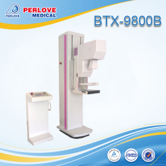 X ray system mammography bilateral