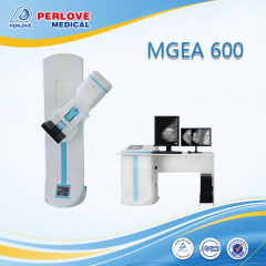 Digital stationary Xray for mammography system