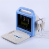 Patient Monitor 12 inches LCD monitor Laptop Color Doppler Ultrasound Scanner