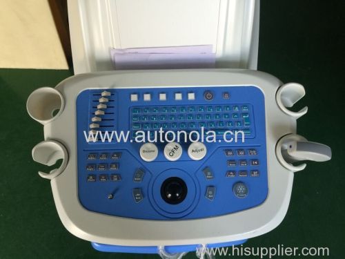 80 elements Color Doppler trolley Medical equipments ATNL 6800