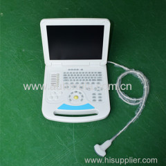 Full Digital Notebook Color Doppler ATNL6800