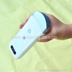 Convenience wireless convex probe ultrasound machine